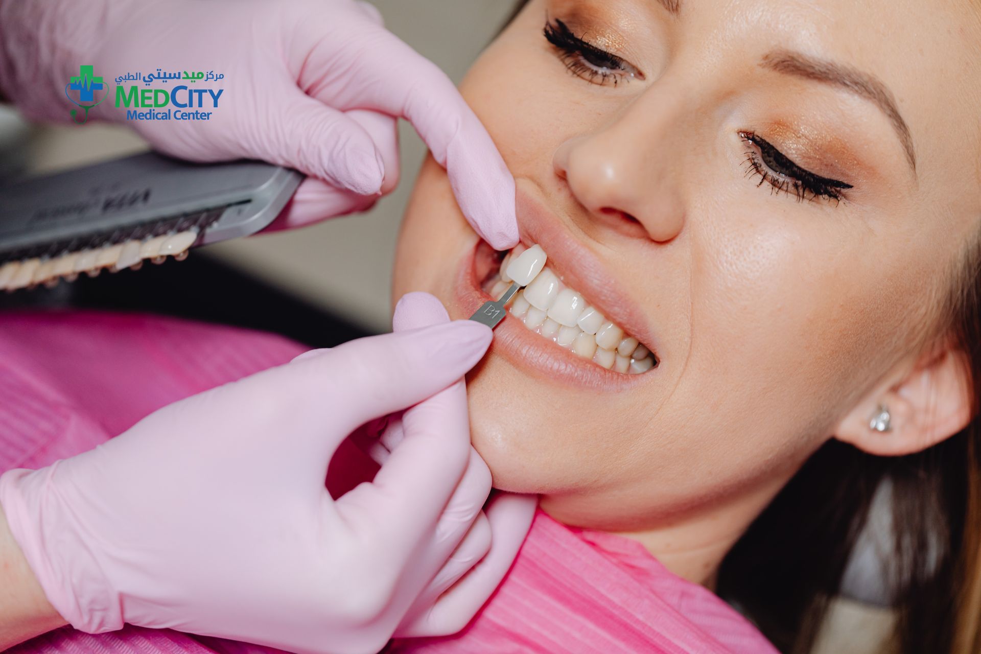 Dental Veneers in Ras Al Khaimah